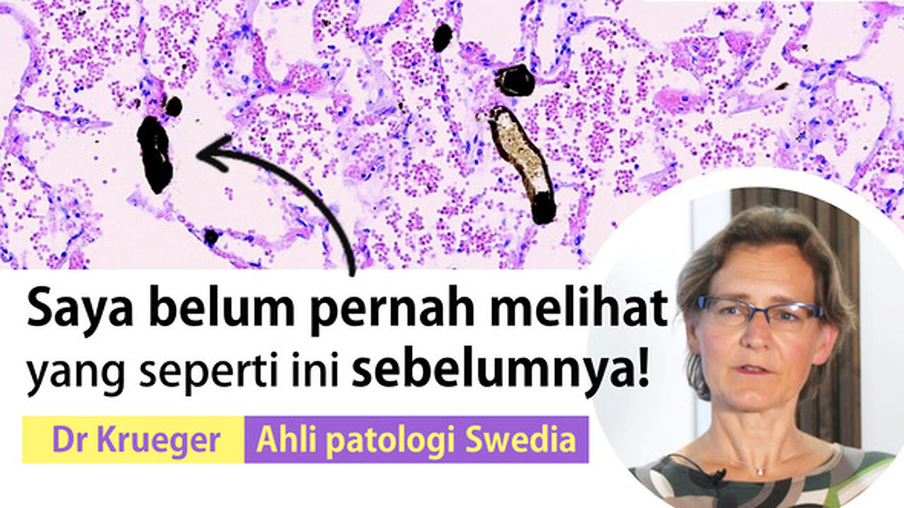 Vaksinasi mRNA Corona - penyebab penyakit dan kematian? Wawancara dengan Dr Ute Krüger, MD