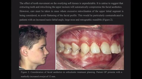 Orthodontics L8 (Treatment Planning and Forming a Problem List)