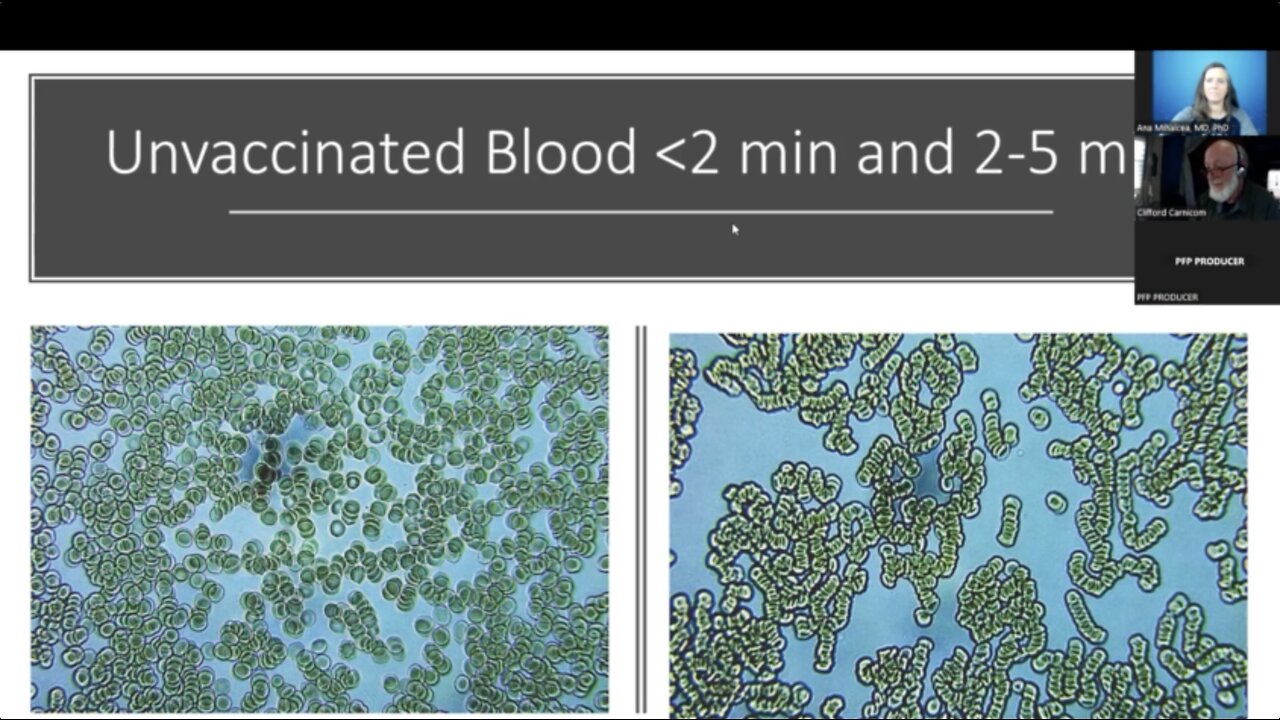 Synthetic Biological Life Forms – CDB, Morgellons, Live Blood Findings in Post C19 Injection Era