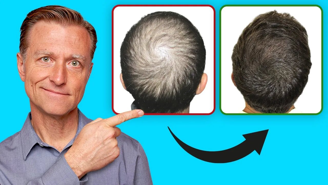 How to Regrow Your Hair (UPDATED VITAL INFO)