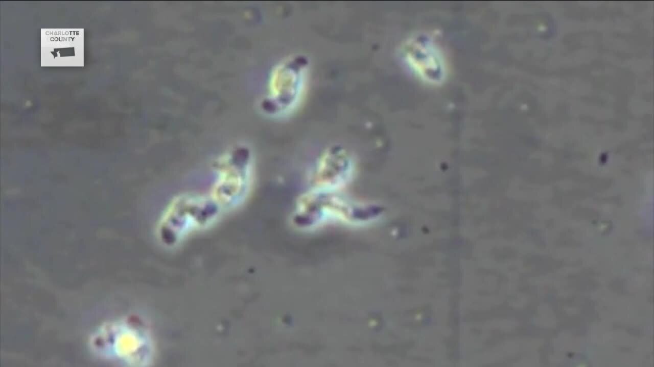 DOH: Amoeba found in single faucet, while all other tests come back negative