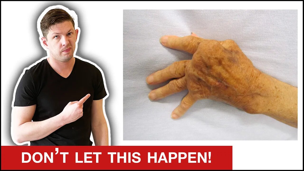 How to Heal Arthritis Naturally