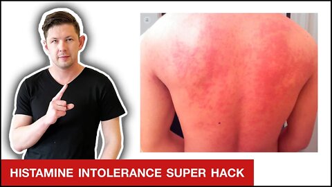 How To Heal Histamine Intolerance