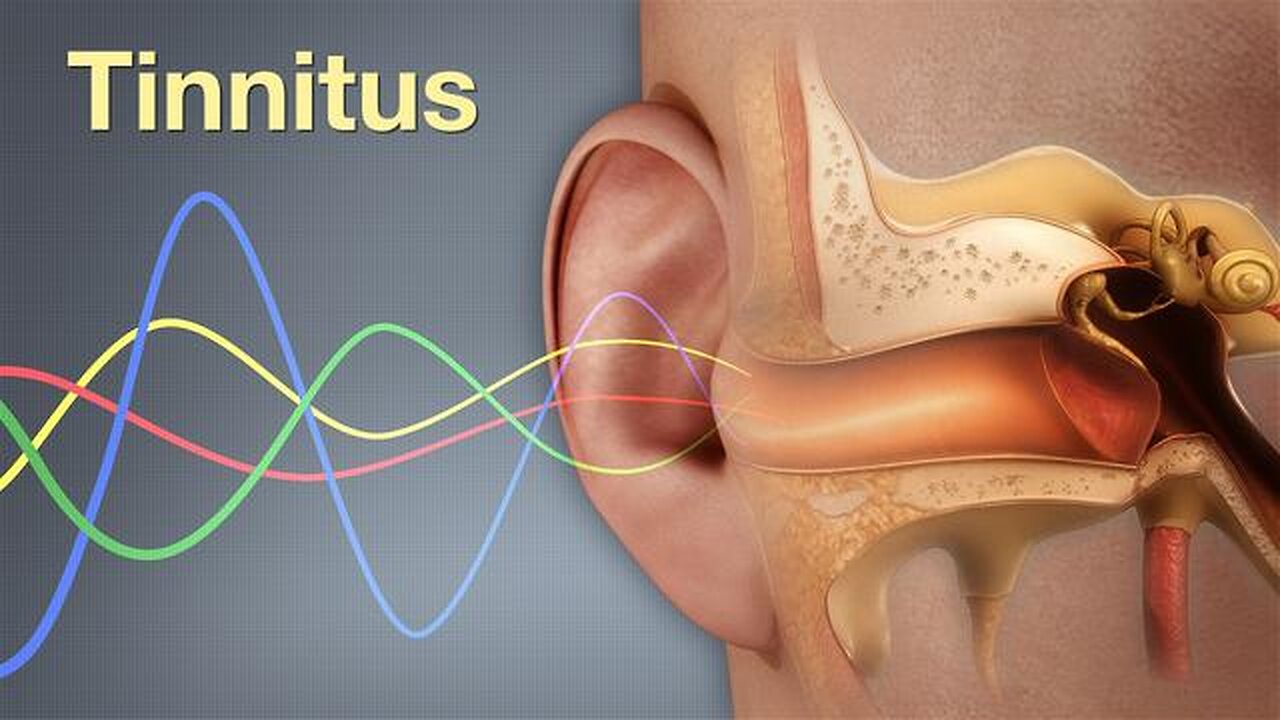 Root Cause Of Tinnitus: We Can Hear Electricity?