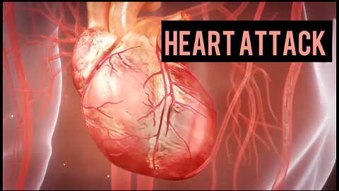 HEART ATTACK 3D ANIMATION