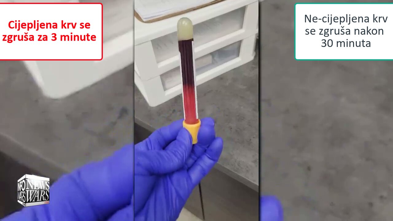Vaccinated blood has clotted in 3 minutes - unvaccinated normally in 30 minutes