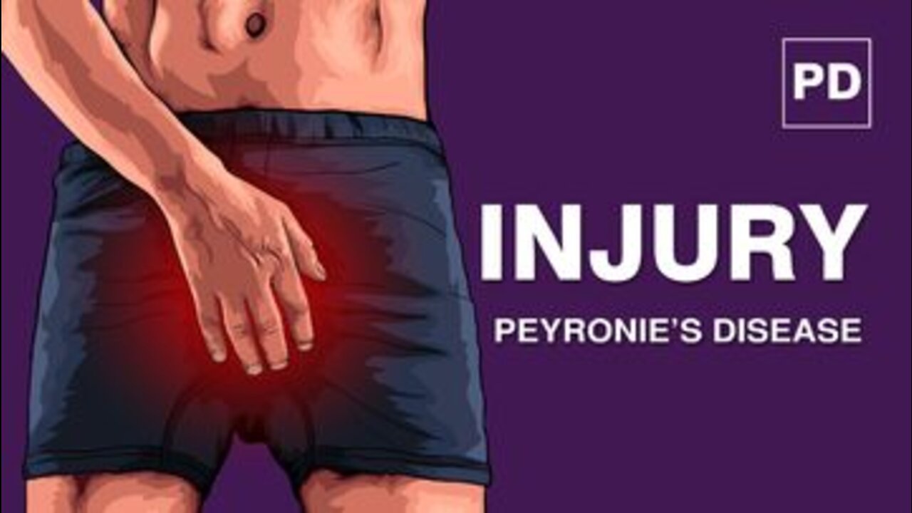 Peyronie’s Disease and Injury | How Small Injury Causes Peyronie's Disease | Mansmatters