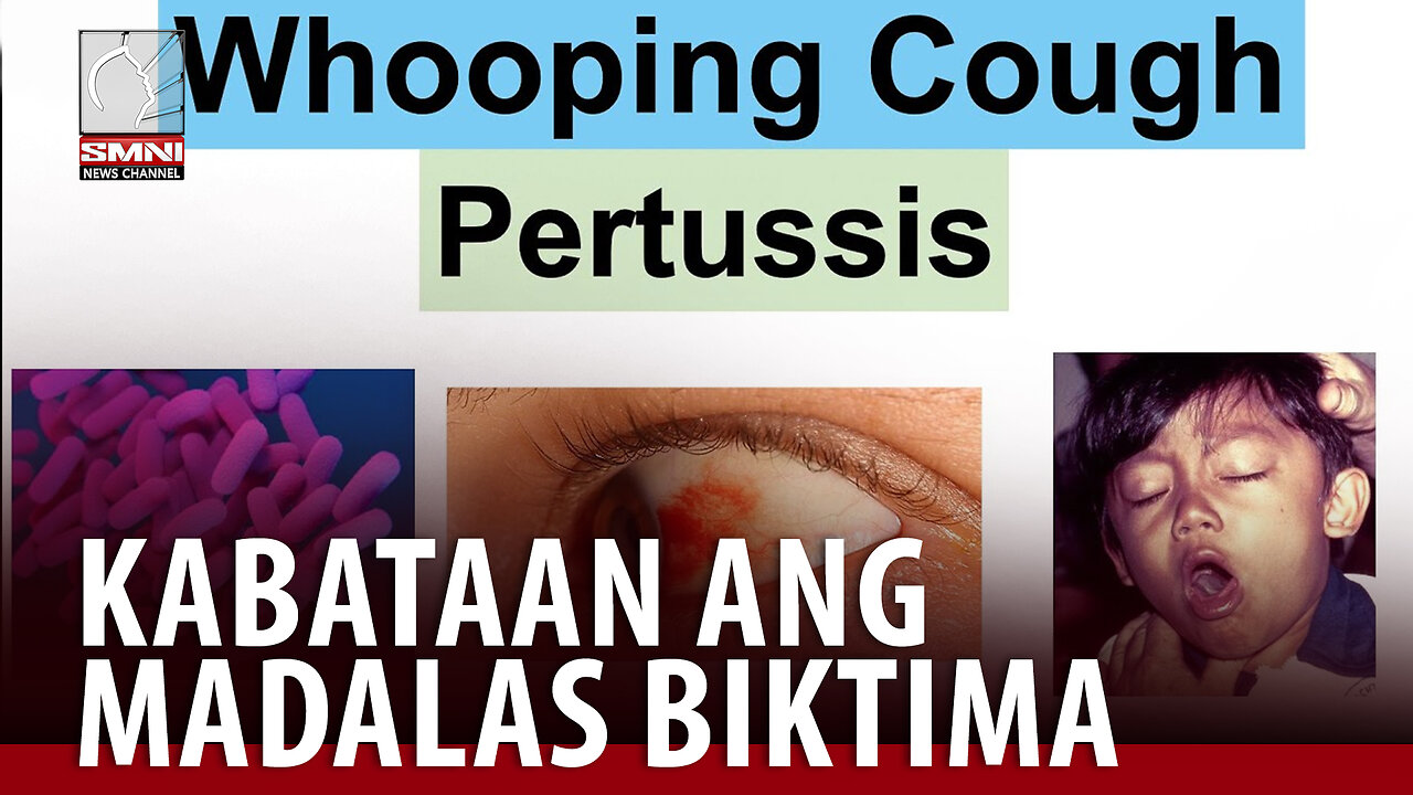 Sakit na Pertussis, mga kabataan ang madalas na biktima —Usec. Eric Tayag, DOH Spox.