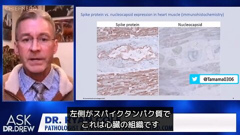 【コロワク】コロナ感染ではなくワクチンで亡くなっていることの証明