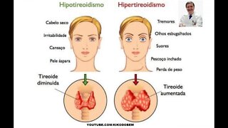 HORMÔNIOS T3 E T4 COMO MANTER A TIREÓIDE REGULADA EVITANDO HIPOTIREOIDISMO E HIPERTIRÓIDISMO