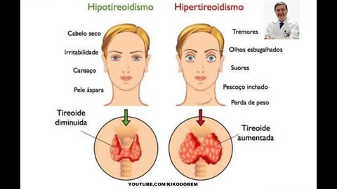 HORMÔNIOS T3 E T4 COMO MANTER A TIREÓIDE REGULADA EVITANDO HIPOTIREOIDISMO E HIPERTIRÓIDISMO