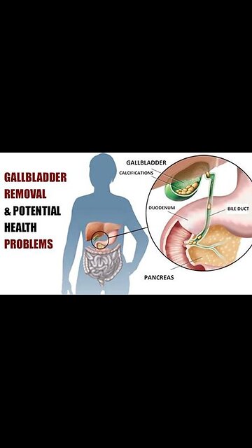 Don't let the Medical Mafia take out your gallbladder. It has a function