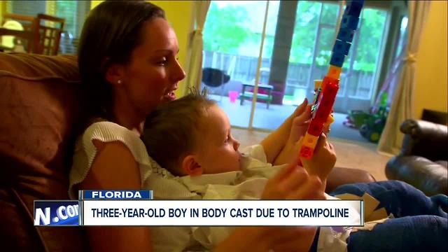 Florida mom speaks out after her toddler got injured at a trampoline park