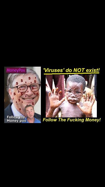 GREED! Follow the Fucking MONKEY-POX aká MONEY-POX 'VIRUS' PLAN-Demic!