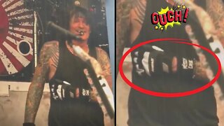 Tommy Lee Replaced During Motley Crue's First Stadium Show After Suffering Injury