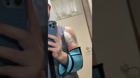 Really Rough Pec Tear Recovery