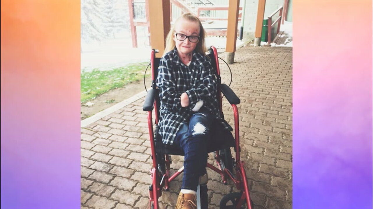 EB Took My Hands And My Hair - But Not My Spirit | BORN DIFFERENT