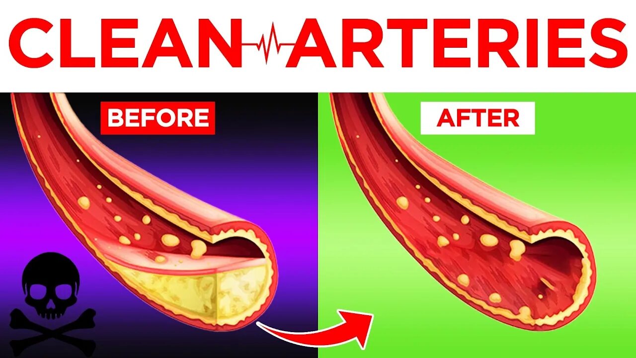 Clear Your Arteries with These Nutritious Foods