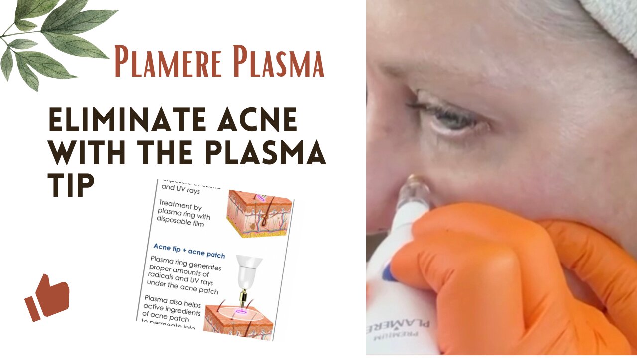 Eliminate Acne with the Plamere Plasma Pen