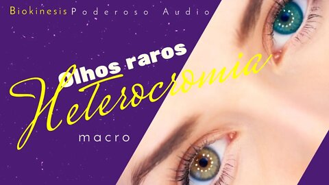 Biokinesis Tenha Olhos raros com Heterocromia