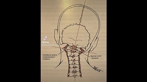 What is your spine 🦴 responsible for?? What role does your upper neck serve in?