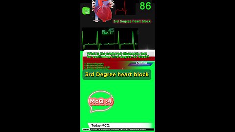 Third Degree Atrioventricular Block: heart, cardiology, atrioventricular block,MCQS