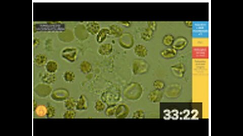 NEXT DOSE 2: But what is in these injections?