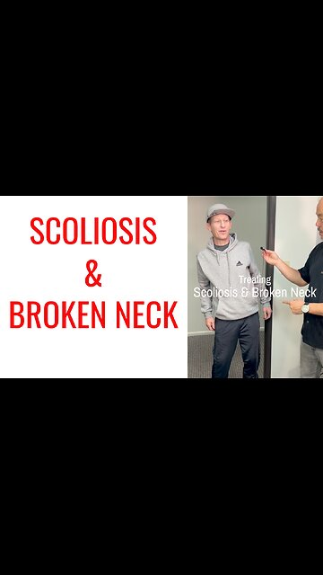 Scoliosis & Broken Neck gets treated by Chiropractor