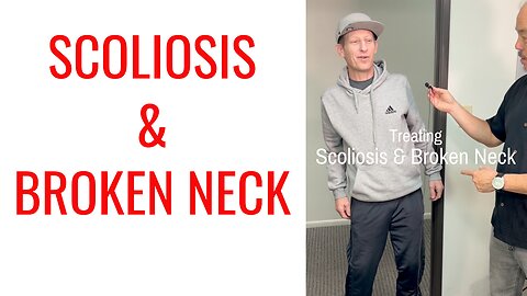 Scoliosis & Broken Neck gets treated by Chiropractor