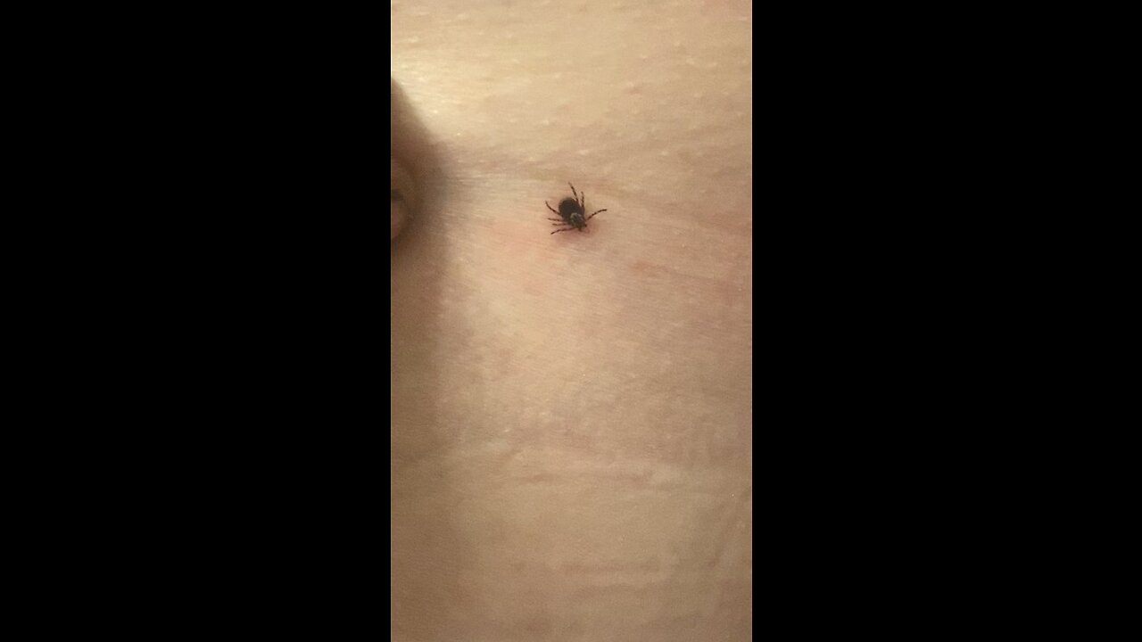 Tick removal