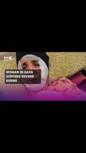 Woman in Gaza severely burned in Israeli air strike