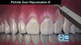 Dr. John Chao, dentist & inventor of "Pinhole Gum Rejuvenation®"