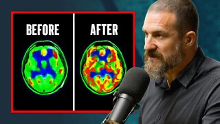 Andrew Huberman - Does Dopamine Detoxing Actually Work?