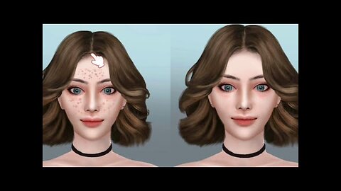 ASMR Face acne remover with tools| 2D animation| ASMR
