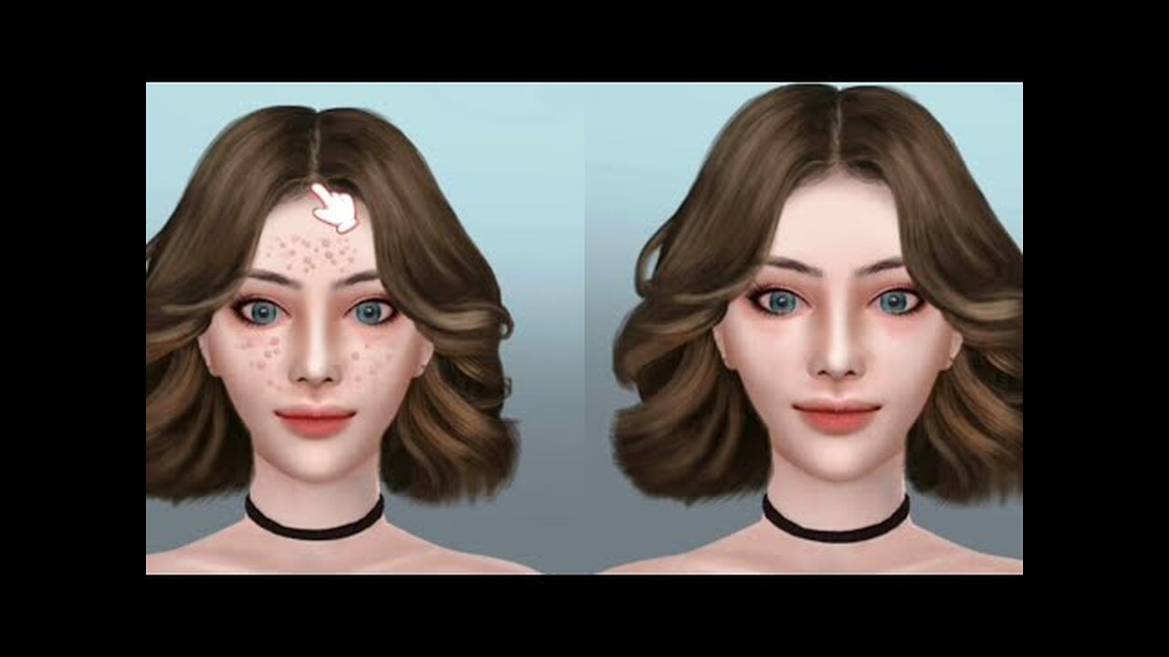 ASMR Face acne remover with tools| 2D animation| ASMR