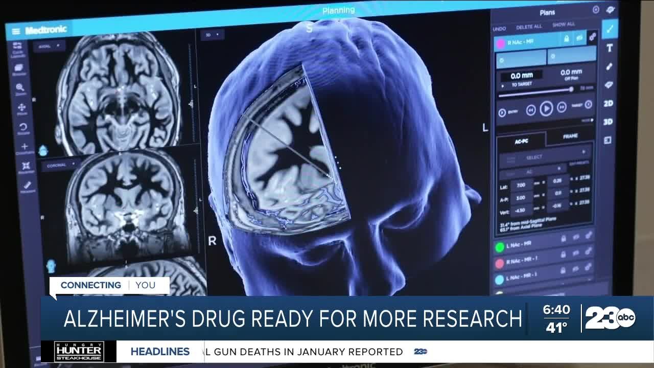 FDA approves Alzheimer's drug for further research