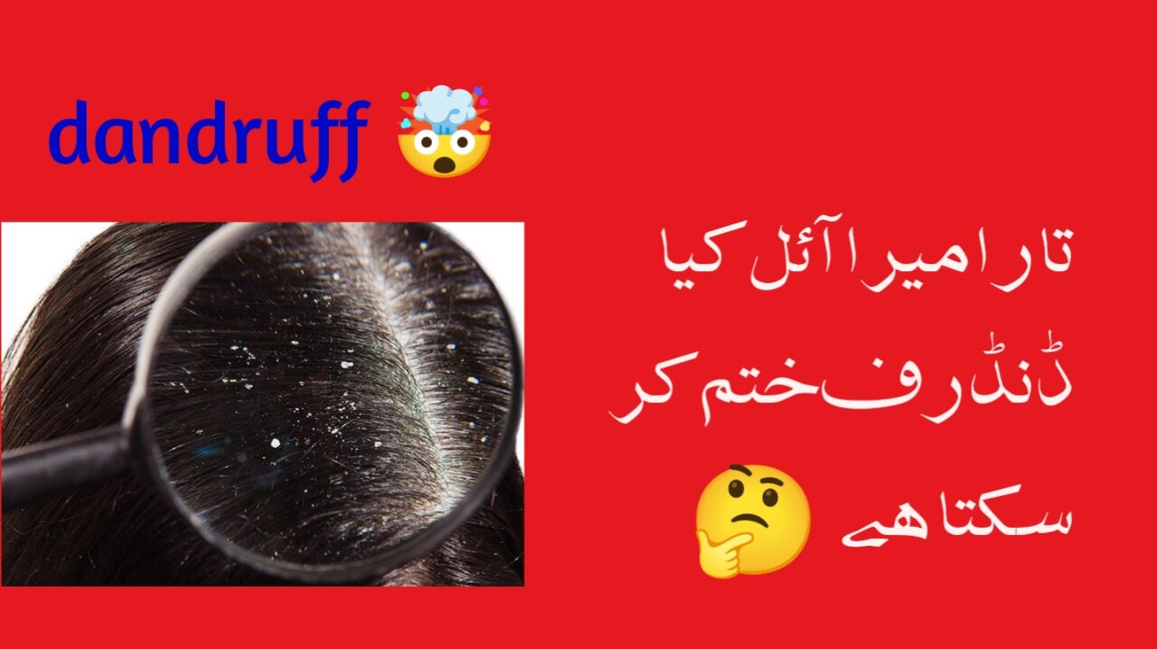 Remove Dandruff permanently | Treatment of dandruff at home |