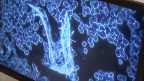 Grafene nei vaccini anti Covid-19, analisi di microscopia ottica ed elettronica