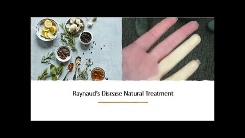 Raynaud's Disease Natural Treatment