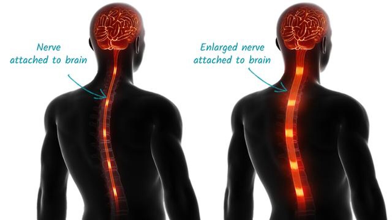 DISCOVERS HIDDEN OFF SWITCH FOR AGONY FROM ARTHRITIS, BACK ACHE, AND CHRONIC PAIN