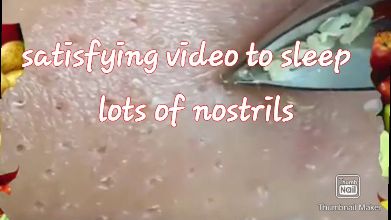 Blackhead removal satisfying video #4