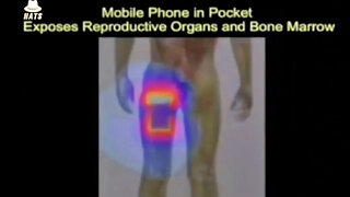 The Shocking Damage Mobile Phone Radiation Does to the Human Body