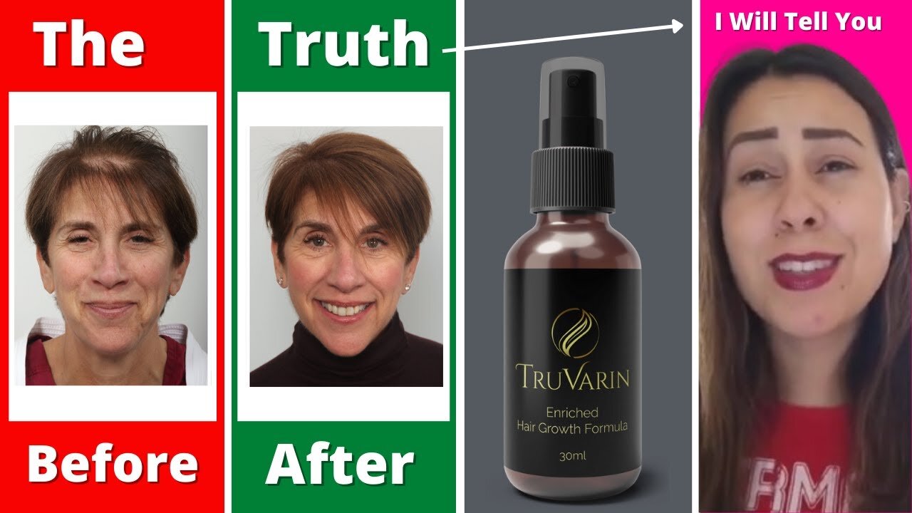 Truvarin Reviews | (⚠️ ALERT!⚠️) | Truvarin Hair Growth | Truvarin Hair | Truvarin Hair Supplment