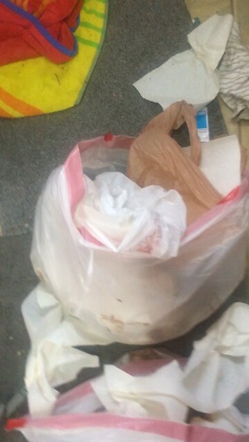 MY FAMILY IS KILLING ME “TORTURED ALIVE” STOLE MY BUDESONIDE