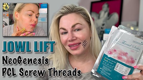 Jowl Lift with NeoGenesis PCL Screw Threads, Glamcosm! Code Jessica10 saves you Money!