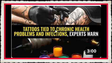 Tattoos tied to chronic health problems and infections, experts warn