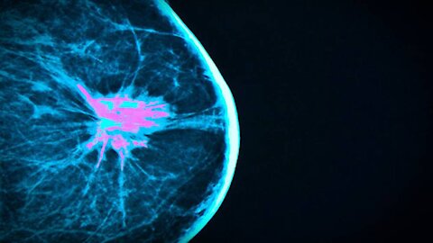 COVID Vaccines And Positive Cancer Results!!!