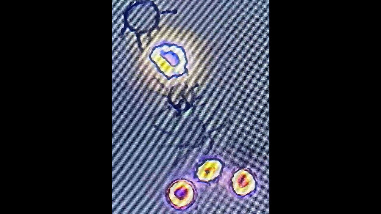 pHase Contrast Optical Microscopy Reveals Spike Protein Being Born OUT of the Red Blood Cell Membranes