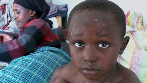 Fitch: Mpox adds to fiscal pressures in Sub-Saharan Africa | REUTERS