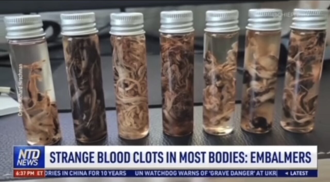 “Mysterious” Blood Clots Found In Corpses?